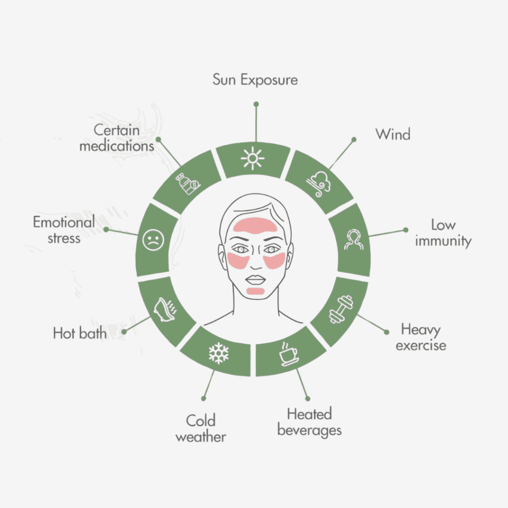 what causes rosacea and the triggers of rosacea